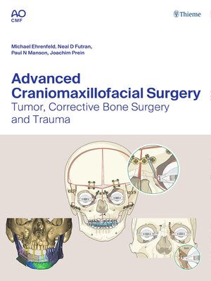 cover image of Advanced Craniomaxillofacial Surgery